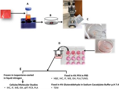 Human Organ Culture: Updating the Approach to Bridge the Gap from In Vitro to In Vivo in Inflammation, Cancer, and Stem Cell Biology